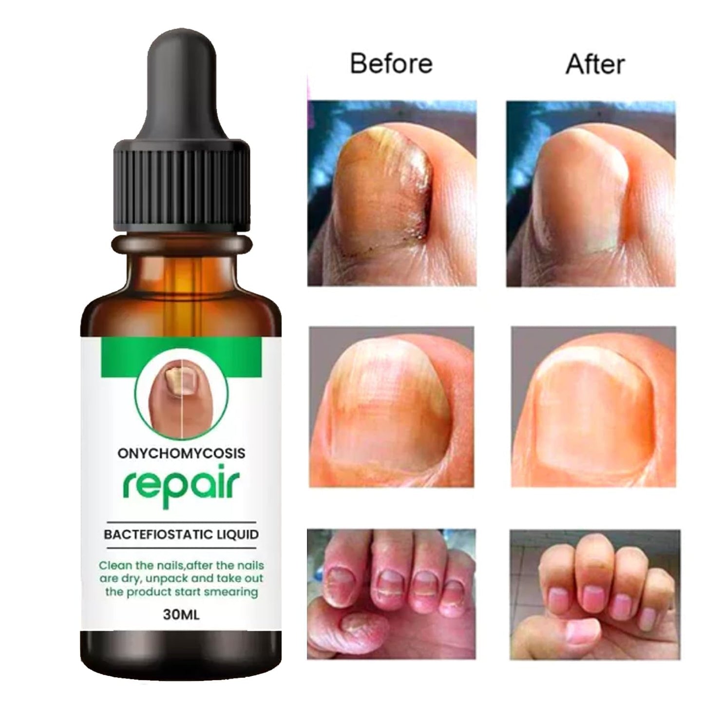 NailCure™ All in one Nail Repair Serum ( Buy 1 Get 1 Free)
